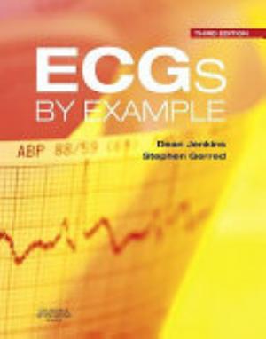 Cover of ECGS BY EXAMPLE 3RD ED